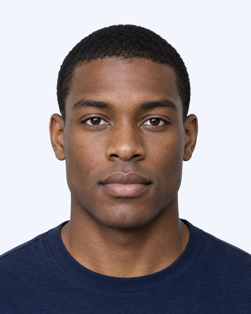 Unedited frontal portrait of Face B for canthal tilt.