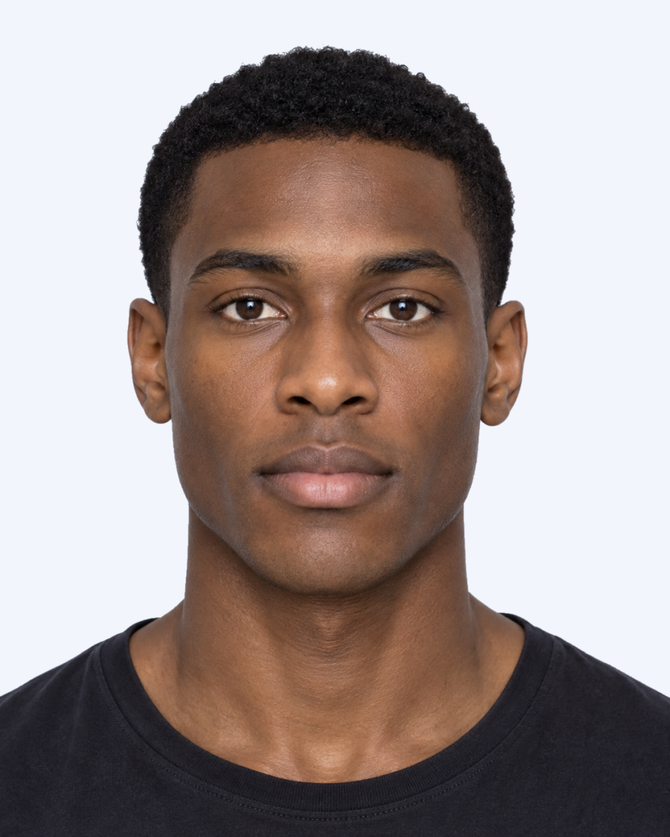 Frontal portrait illustrating mouth-to-interpupillary width ratio